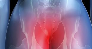 Анокопчиковый болевой синдром